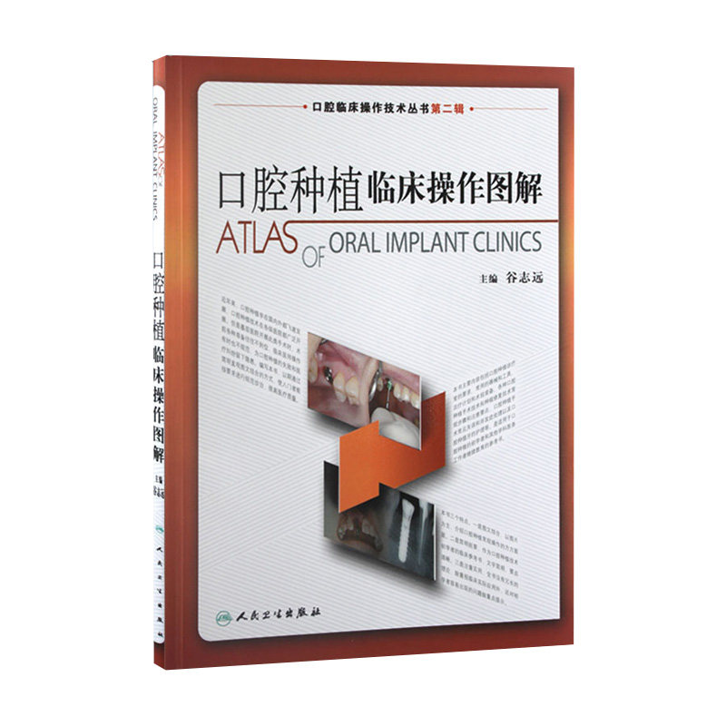 正版 口腔种植临床操作图解 拔牙技巧学义齿全瓷修复颌面外科正畸黏膜病学牙髓之路儿童牙科病历根管治疗口腔医学书籍
