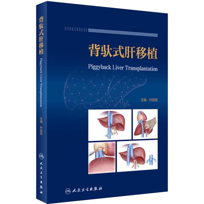 背驮式肝移植 叶啟发主编 背驮式肝移植基础研究临床应用 肝移植术前及术后管理 创新术式规范解读 人民卫生出版社9787117337618