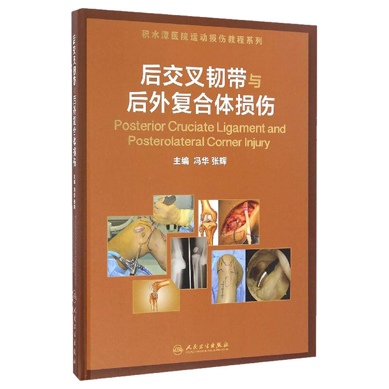 后交叉韧带与后外复合体损伤 冯华,张辉 主编 著 外科普通大众外科 人民卫生出版社 2016年11月参考书 9787117233576