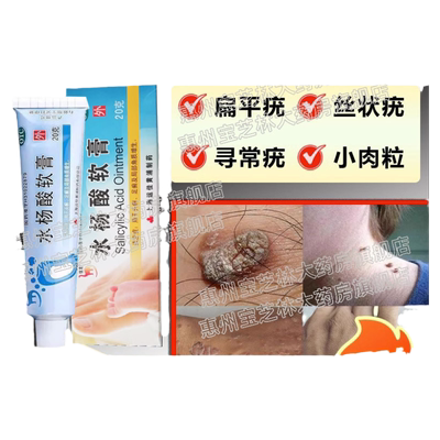 【信龙】水杨酸软膏5%*20g*1支/盒扁平疣乳膏去除去疣瘊子脖子药膏尤瘊疙瘩小肉粒祛