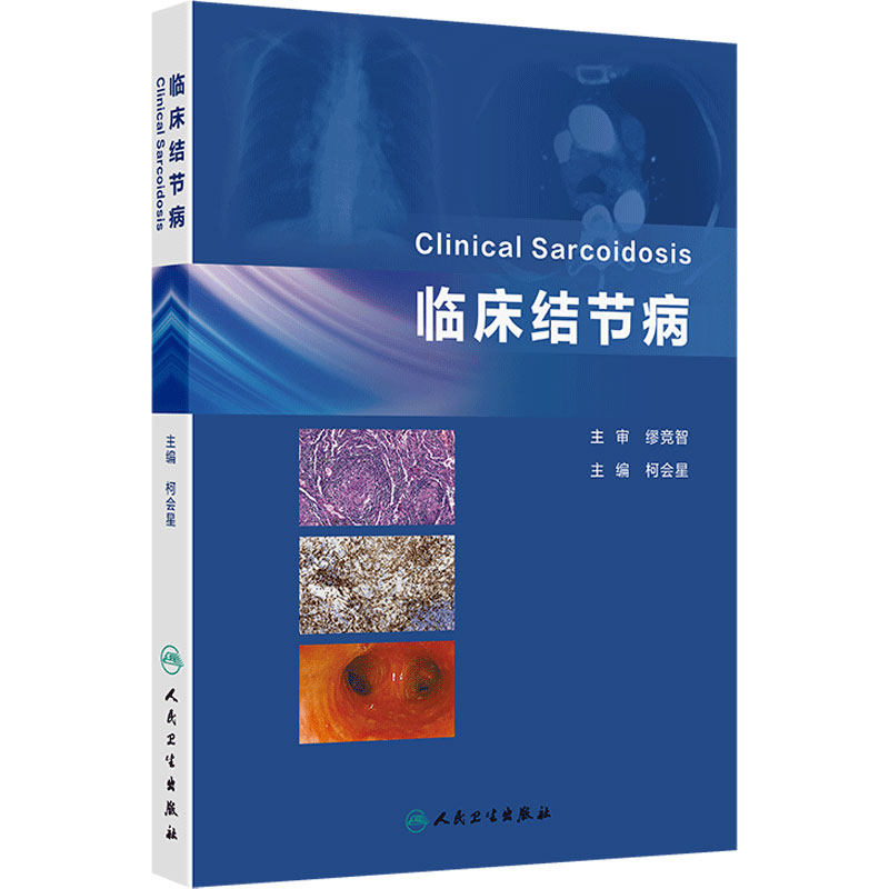 临床结节病 柯会星主编 结节病的影像学表现 适合于呼吸与危重症医学科 影像科 病理科等专科医师阅读9787117370554人民卫生出版社