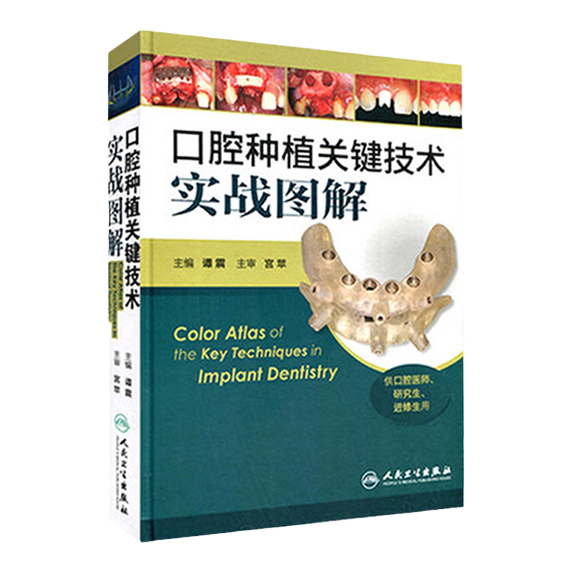 口腔种植关键技术实战图解 彩图版 谭震 供口腔医师研究生进修生用 口腔种植医学参考工具书籍 人民卫生出版社9787117186186