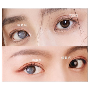 盲人专用美瞳隐形眼镜医用仿真虹膜美容片墨镜无视力盲片遮光遮瑕