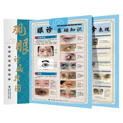 47厘米*68cm张眼诊全彩挂图