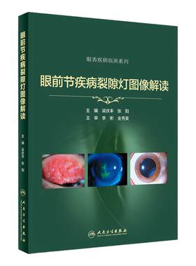 眼前节疾病裂隙灯图像解读实用学中华眼科特检照相技巧青光眼 角膜屈光手术并发症案例图解眼表疾病临床诊断视网膜人卫医学书籍
