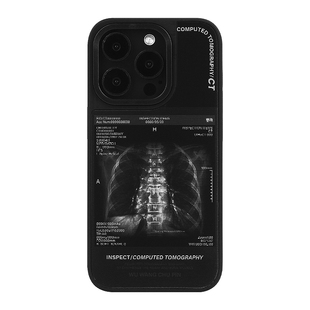 悟望初品 人体X光片骨骼检查CT手机壳磁吸变幻黑色炫酷个性ins风原创意设计适用苹果17iPhone16ProMax15pro14