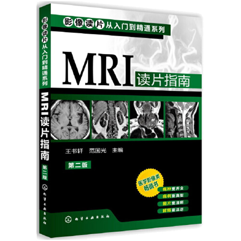 MRI读片指南 第三版 影像读片从入门到精通系列 范国光 杨峰 主编 化学工业出版社 颅内肿瘤 成人弥漫性胶质瘤 室管膜瘤
