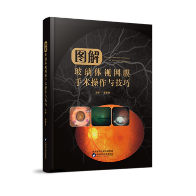 图解玻璃体视网膜手术操作与技巧 雷春灵青少年玻璃体视网膜疾病视觉康复眼保健改善保护视力指导临床眼科验光眼外科手术医学书籍