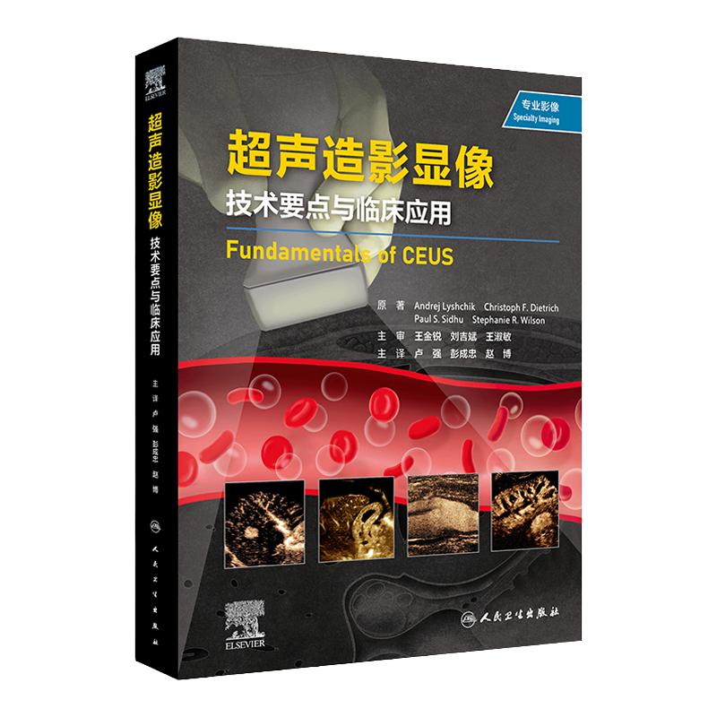 超声造影显像技术要点与临床应用