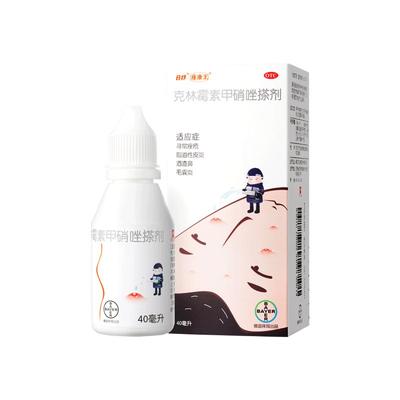 【座康王】克林霉素甲硝唑搽剂10mg8mg*40ml*1瓶/盒痤康王祛痘青春痘痤疮药去黑头