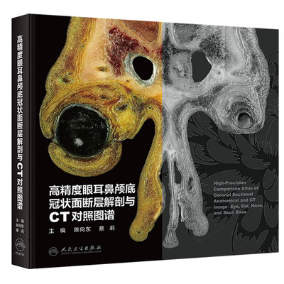 高精度眼耳鼻颅底冠状面断层解剖与CT对照图谱 陈向东 蔡莉 主编 组织色泽真实 清晰显示肌肉纹理人民卫生出版社 9787117389396