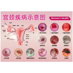 妇科宫颈私处疾病子宫生殖变化图谱产康私密宣传纸页加厚塑封医美