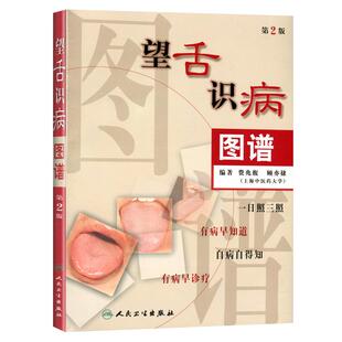 望舌识病图谱 费兆馥顾亦棣编著 人民卫生出版社 图解舌诊 中医舌诊教材书籍 舌像,舌苔,舌象,望舌诊病彩色图解