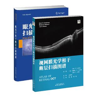眼光学相干断层扫描图谱+视网膜光学相干断层扫描图谱 眼科常见疾病 眼科学 糖尿病性黄斑水肿 眼科疾病诊疗病理性近视遗传性疾病