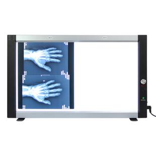 X光阅片灯CT核磁骨科看片灯led观片灯箱牙科双三联超薄医用观片灯