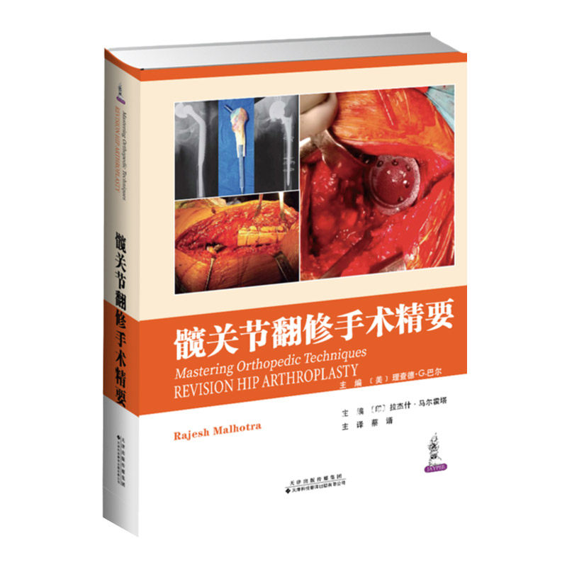 髋关节翻修手术精要 外科学医学参考书籍 美 理查德 G 巴尔 印 拉杰什 马尔霍塔主编 9787543340558 天津科技翻译出版公司