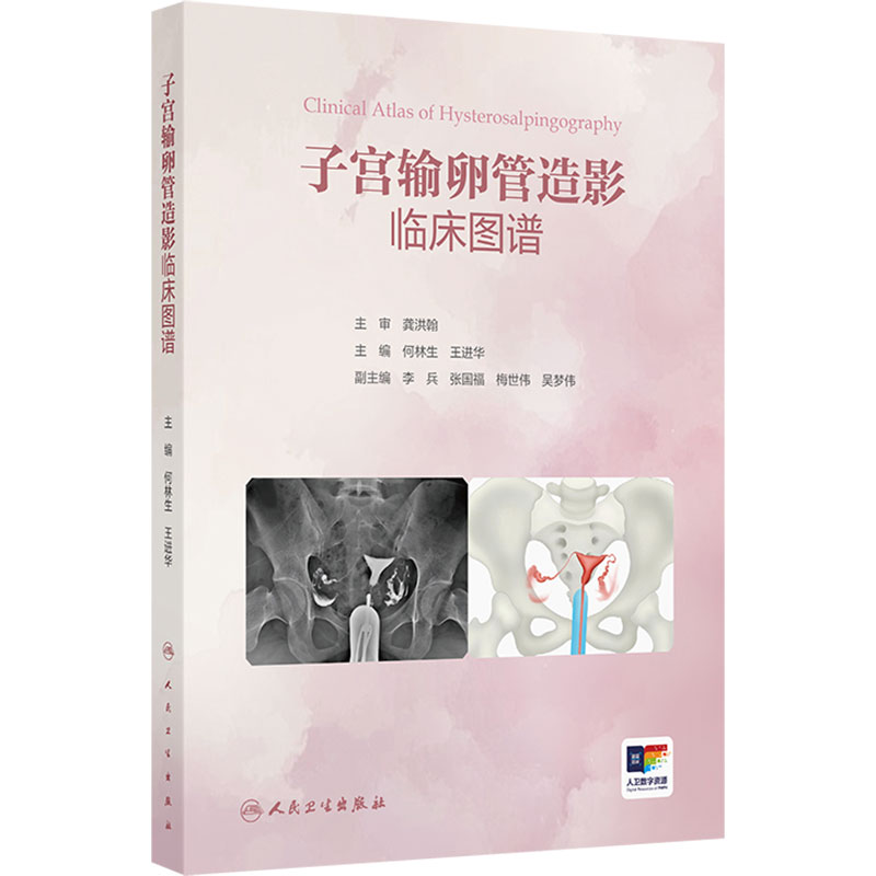 子宫输卵管造影临床图谱 何林生 王进华 主编 直观展示子宫输卵管造影的技术疾病诊断等 人民卫生出版社 9787117396257
