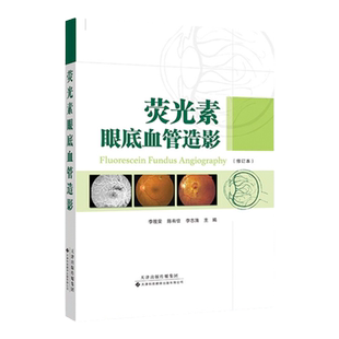【官方直营】荧光素眼底血管造影 荧光造影 虹膜血管造影 血管造影对眼底病的诊断 视网膜血管性疾病 视神经疾病 葡萄膜炎眼内肿瘤