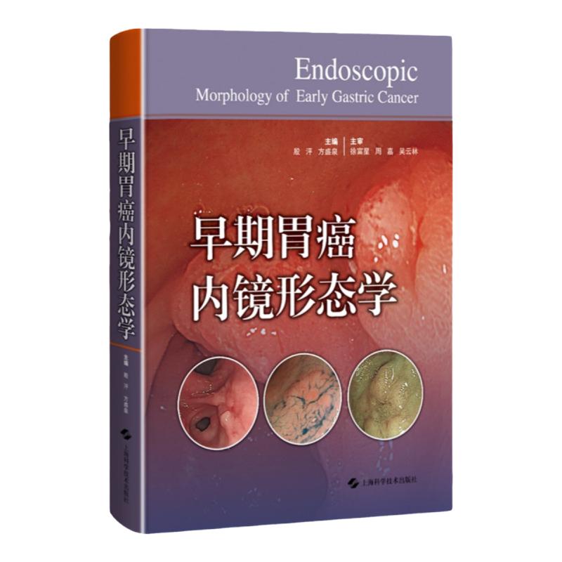 早期胃癌内镜正版包邮多仓发货