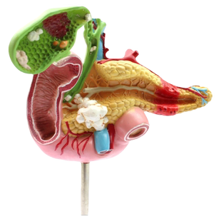 ENOVO颐诺医学胰腺十二指肠胆囊病理模型外科消化科系统模具肝胆科模型专科医生医学住院医师教学上海教具