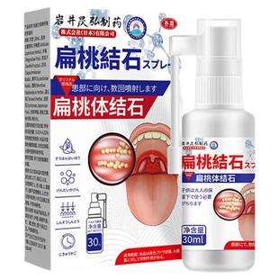 口臭扁桃体结石去除工具漱口水喷剂清理神器口腔清洗器隐窝冲洗器