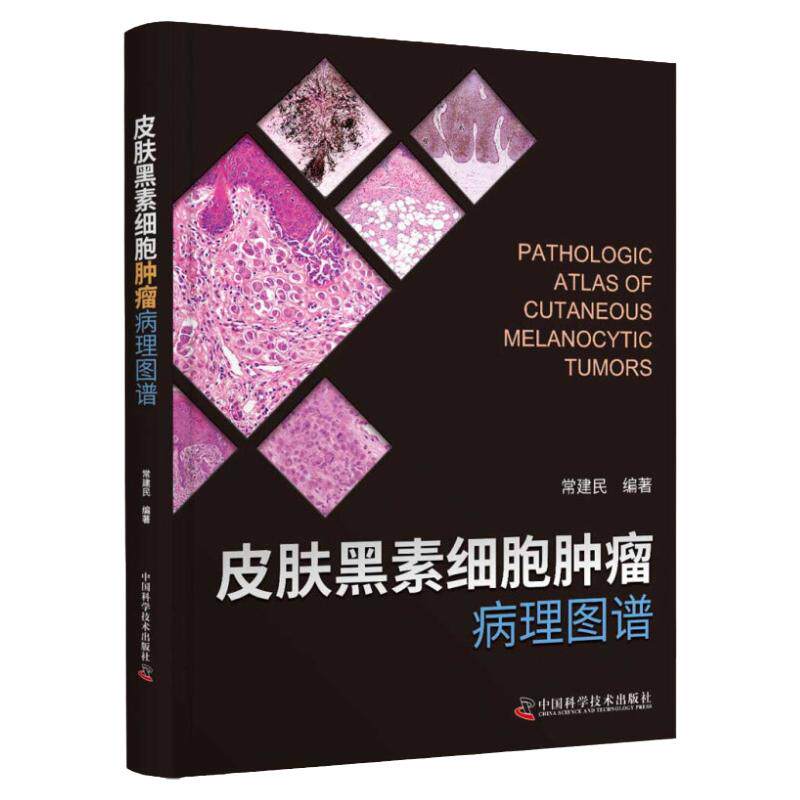 zgkj皮肤黑素细胞肿瘤病理图谱 本书尤其适合皮肤科临床医师以及病理科医师参考使用 常建民编著 9787504687586 中国科学技术出版