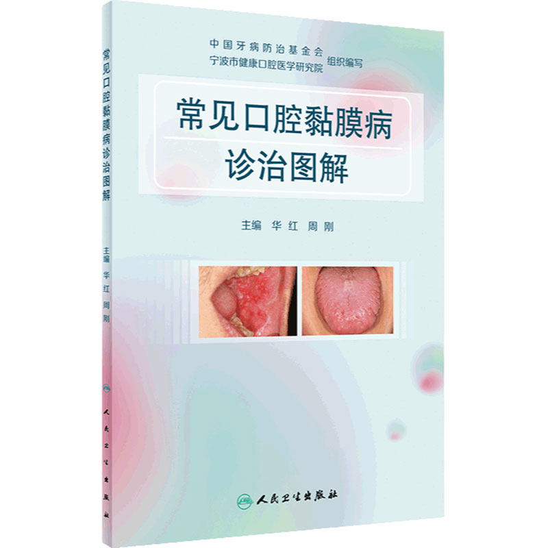 常见口腔黏膜病诊治图解 华红周刚溃疡感染疱疹唇舌斑纹类疾病激光治疗药物抗真菌护理人民卫生出版社医学口腔书籍