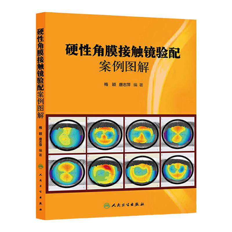 硬性角膜接触镜验配案例图解