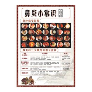 鼻炎科普知识海报医院展板养生挂图诊所宣传画挂画鼻腔结构图墙贴