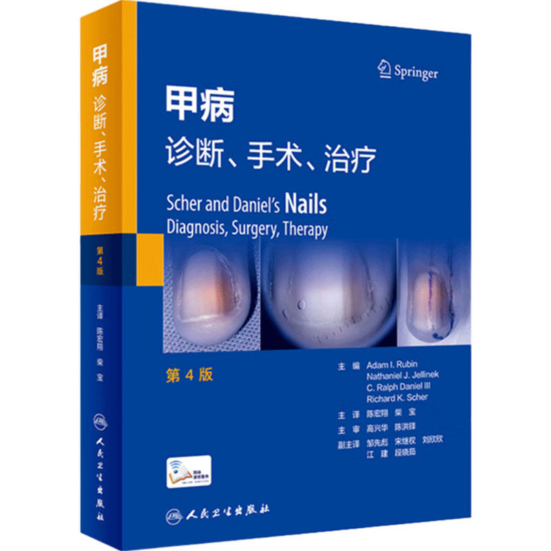 人卫甲病:诊断、手术、治疗