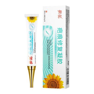 烫伤疤痕膏去疤膏修复凝胶除疤膏祛疤膏儿童专用小孩官方正品手术