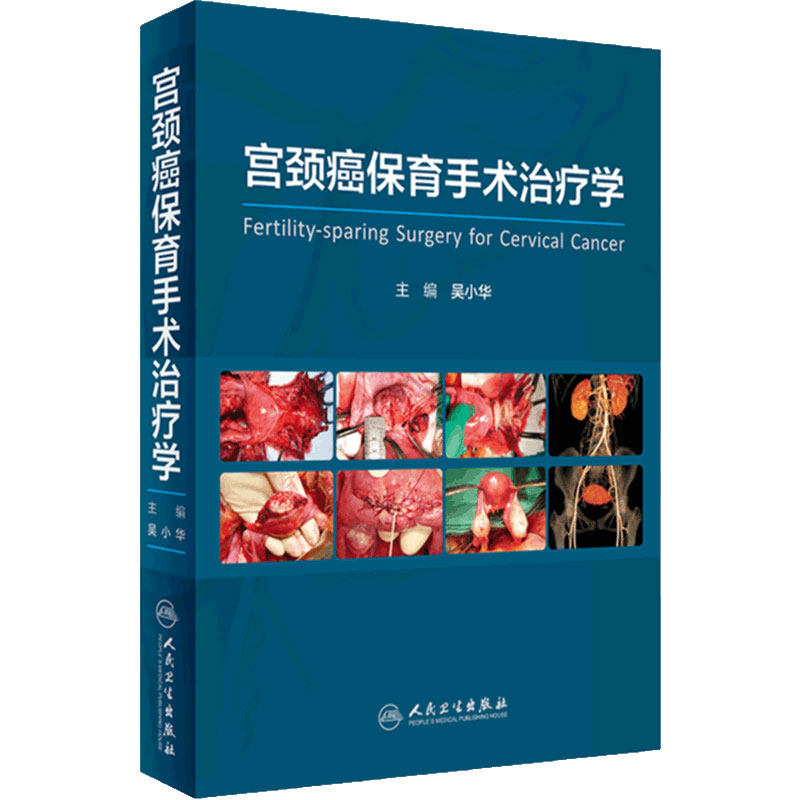 宫颈癌保育手术治疗学人卫