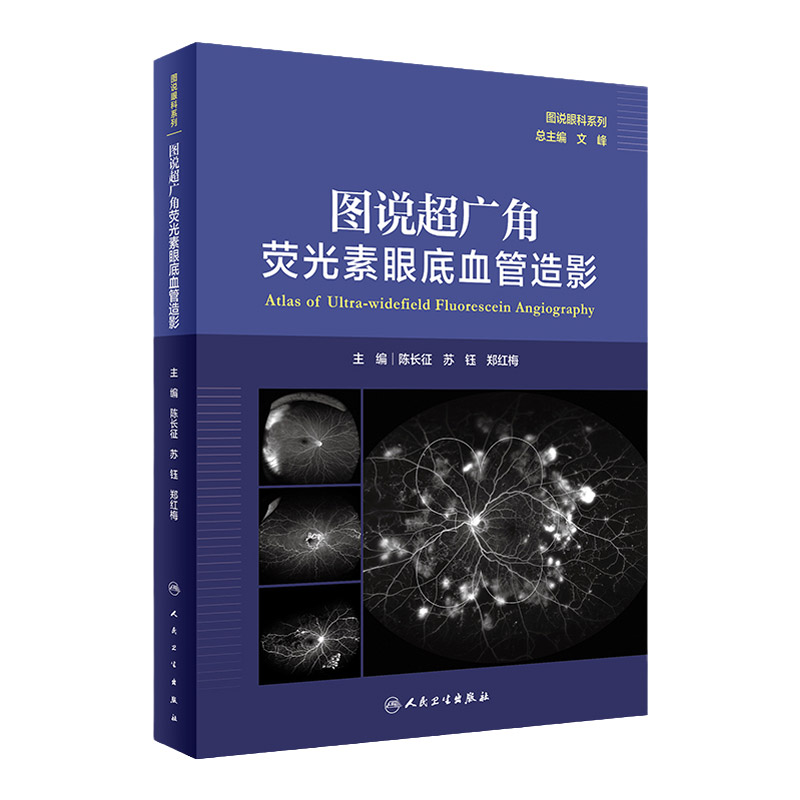 图说超广角荧光素眼底血管造影 图说眼科系列 陈长征 苏钰 郑红梅 主编 超广角眼底自发荧光 人民卫生出版社 9787117314510