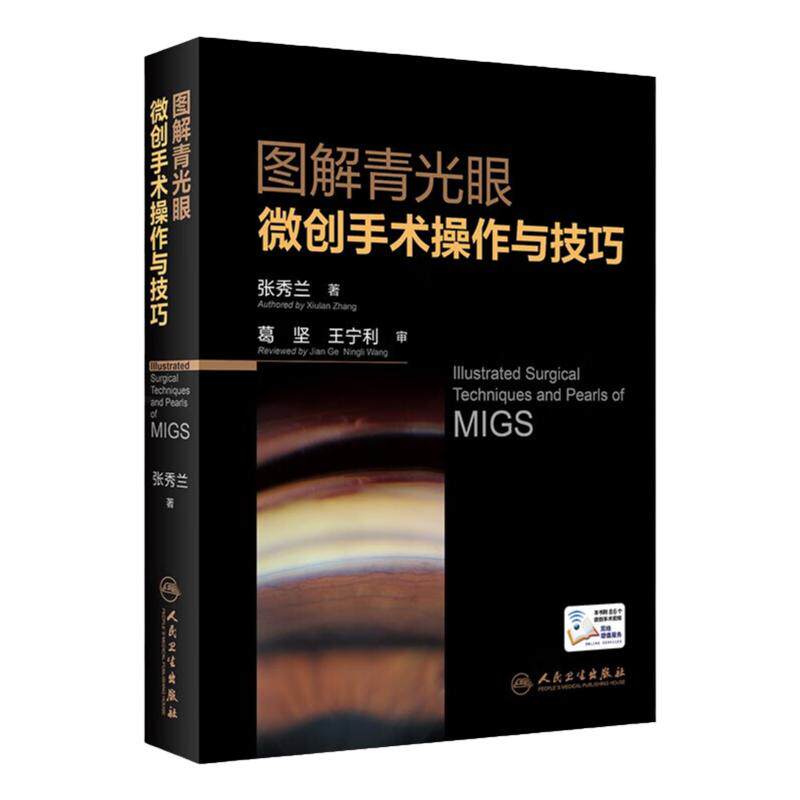 图解青光眼微创手术操作与技巧