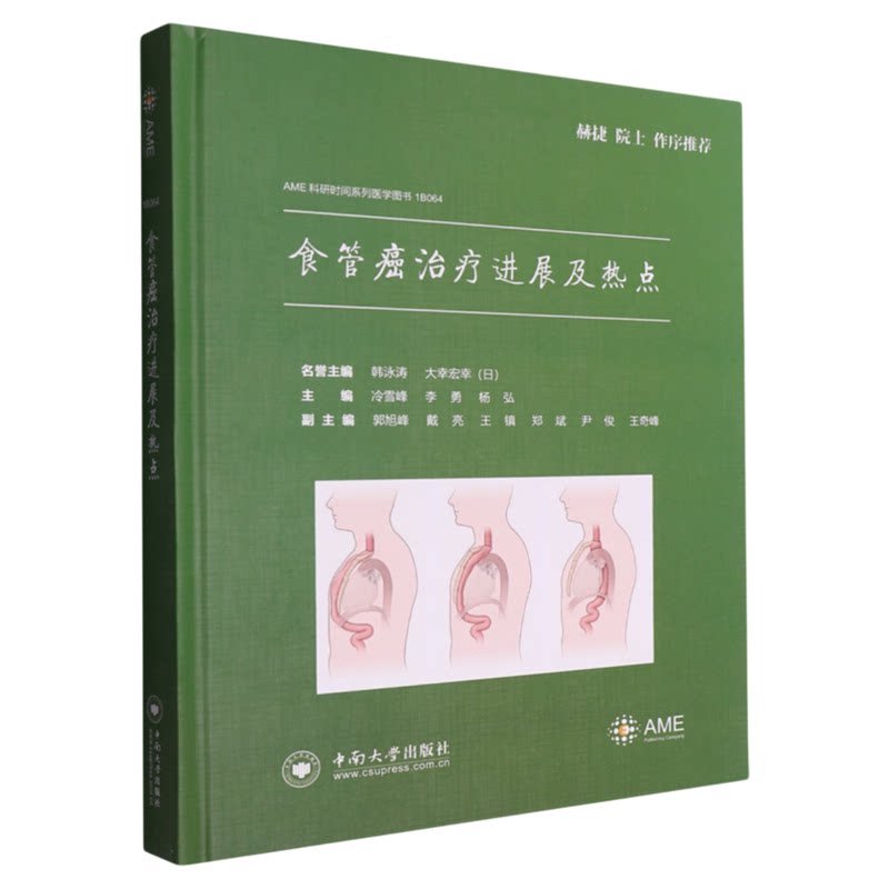 食管癌治疗进展及热点中南出版