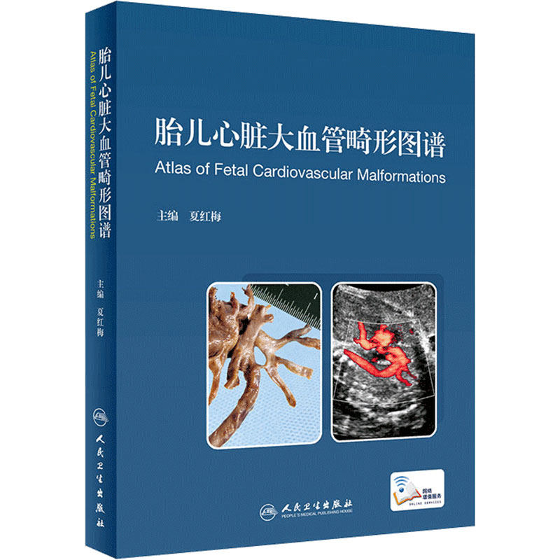 胎儿心脏大血管畸形图谱 胎儿心脏畸形超声诊断 心血管外科学 夏红梅 9787117297097 人民卫生出版社