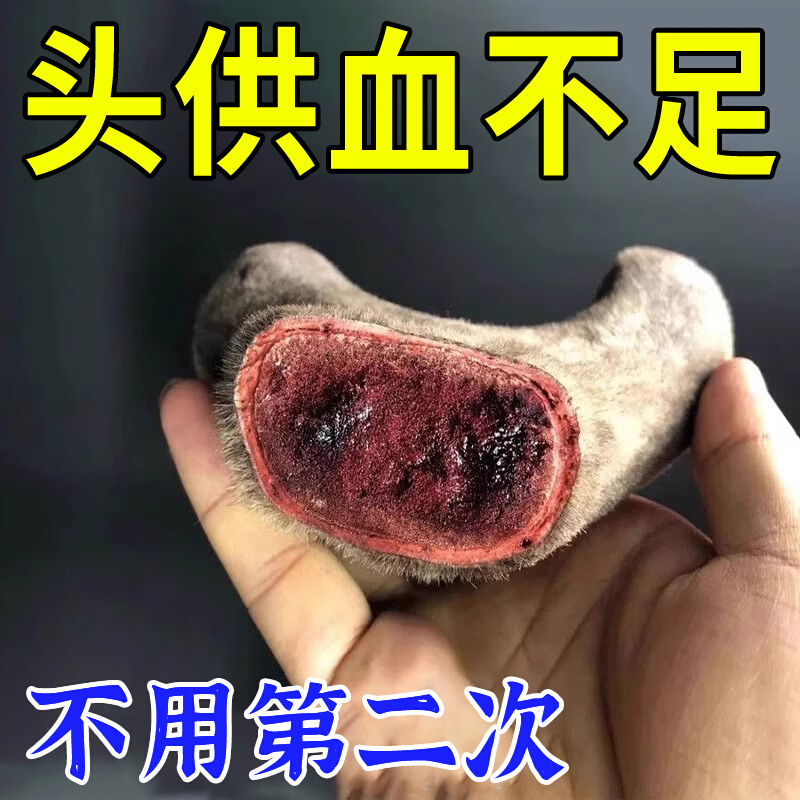 头晕偏头痛头供血不足顽固性头昏头痛神经性脑鸣紧张性眩晕症膏XH