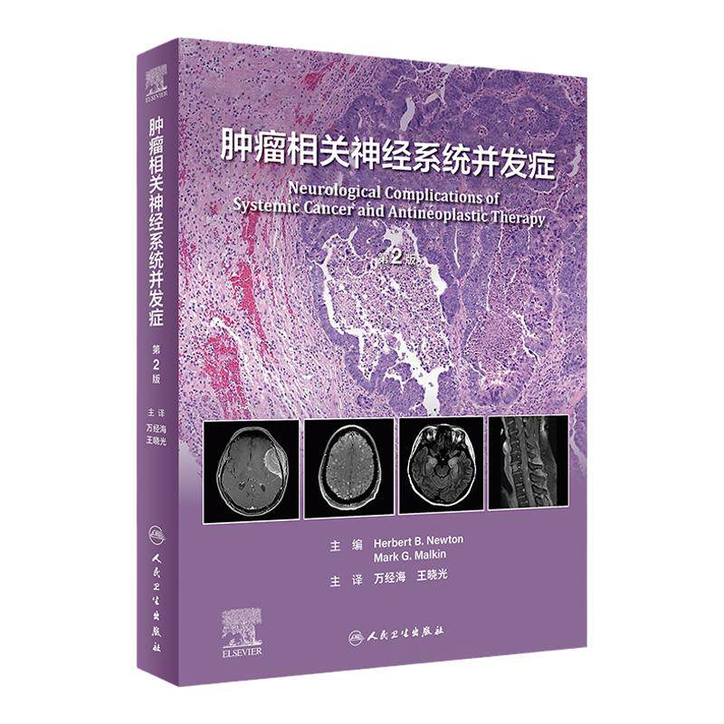 肿瘤相关神经系统并发症第2版万经海王晓光人民卫生出版社经典神经转移性精神护理疼痛治疗外科手术肿瘤神经病学翻译版