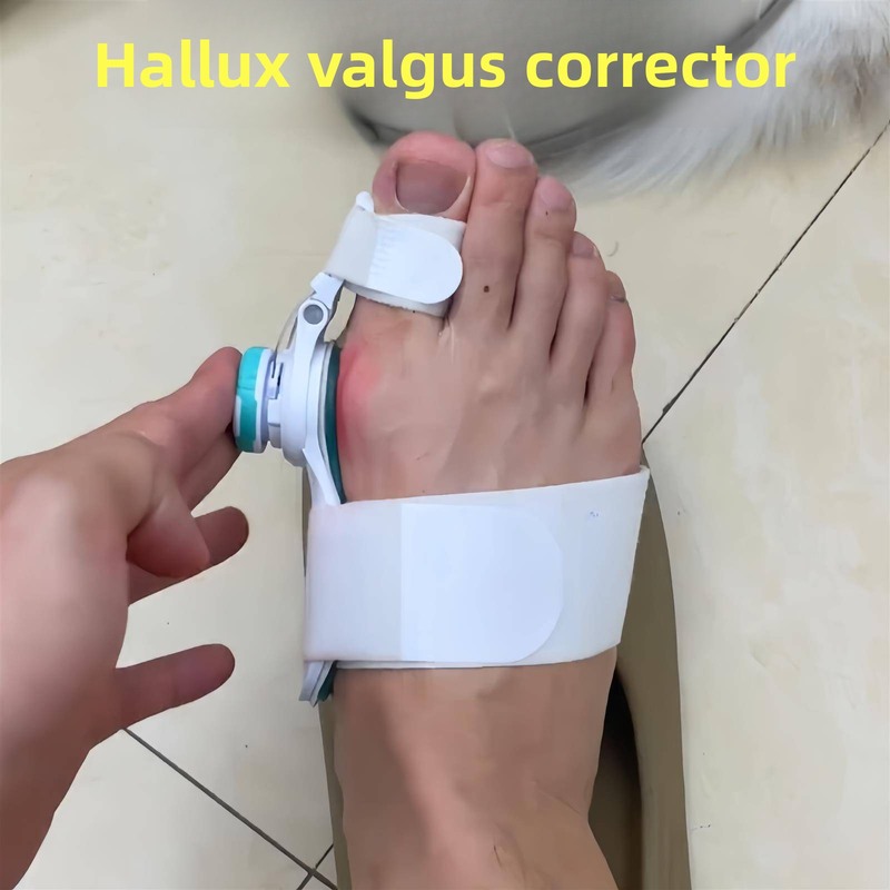 拇外翻矫正器男女可调节大母脚趾分趾器脚骨矫正器足外翻矫形2025