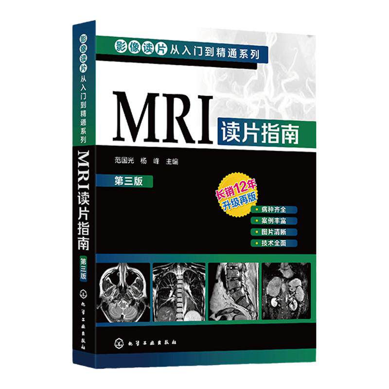 影像读片从入门到精通系列 MRI读片指南 第三版 中国医科大学一附院影像科教授执笔 病种齐全 病例典型图片清晰 强化读片思路技巧