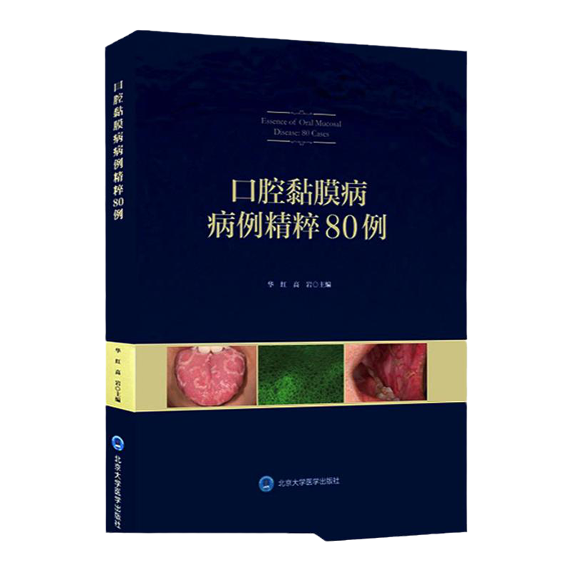 口腔黏膜病病例精粹80例 口腔医学 口腔粘膜溃疡 感染性疾病 唇舌疾病 遗传性疾病 华红 高岩著 9787565919824北京大学医学出版社