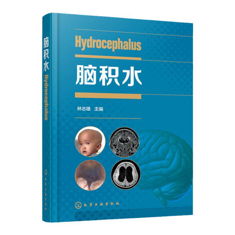 脑积水 林志雄 脑手术技巧周良辅赵继宗王忠诚 神经外科颅底手术入路 显微外科神经内镜 神经外科学书籍 脑血管 脑外科颅脑损伤
