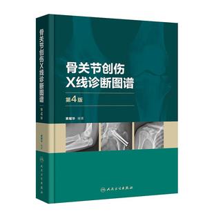 骨关节创伤X线诊断图谱（第4版） 骨科学外科学实用手术学检查临床典型常见病例肩部肘部骨折脱位髋部膝关节脚踝胸部脊柱