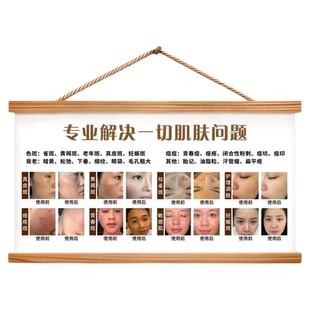 面部点痣图祛痣广告宣传海报相图点痣图挂画男女面痣祛斑点疣贴纸