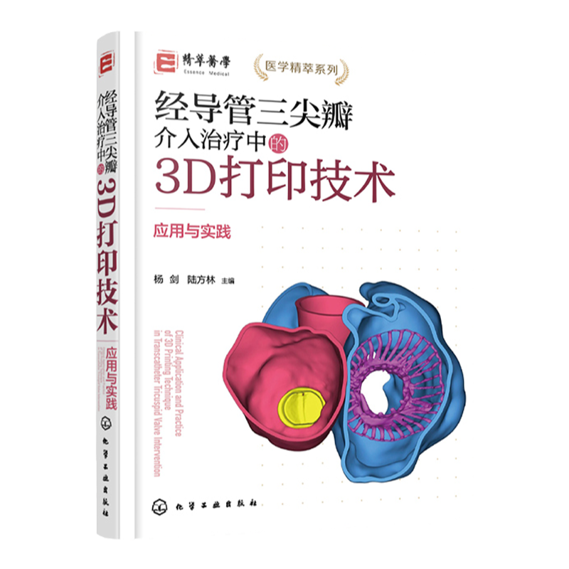 经导管三尖瓣介入治疗中的3D打印技术 应用与实践 3D打印技术在TTVI中应用与实践 结构性心脏病 心血管外科医师等专业医师参考书籍