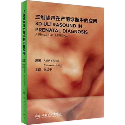 旗舰店现货三维超声产前诊断