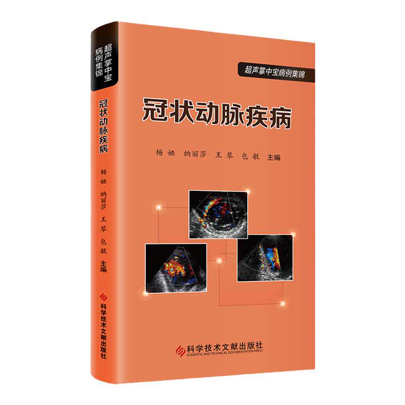 冠状动脉疾病
