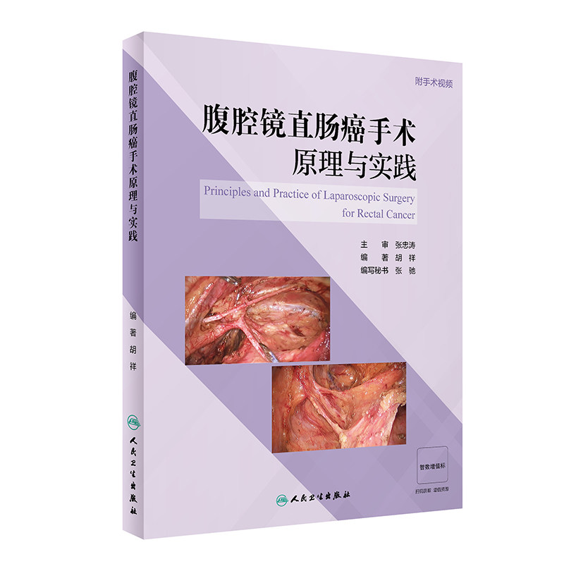 腹腔镜直肠癌手术原理与实践