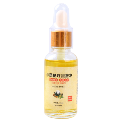痘痘水中药精华液闭口粉刺青春痘
