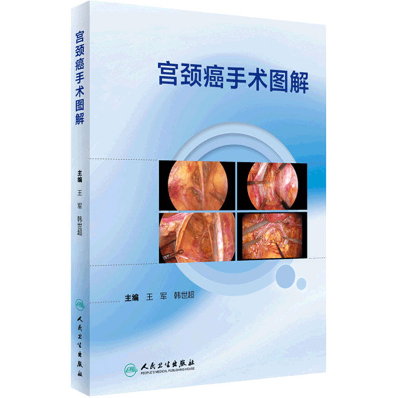 宫颈癌手术图解妇产科学人卫